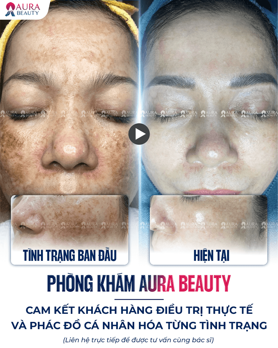 Búp bê mắt đen — Aura Beauty