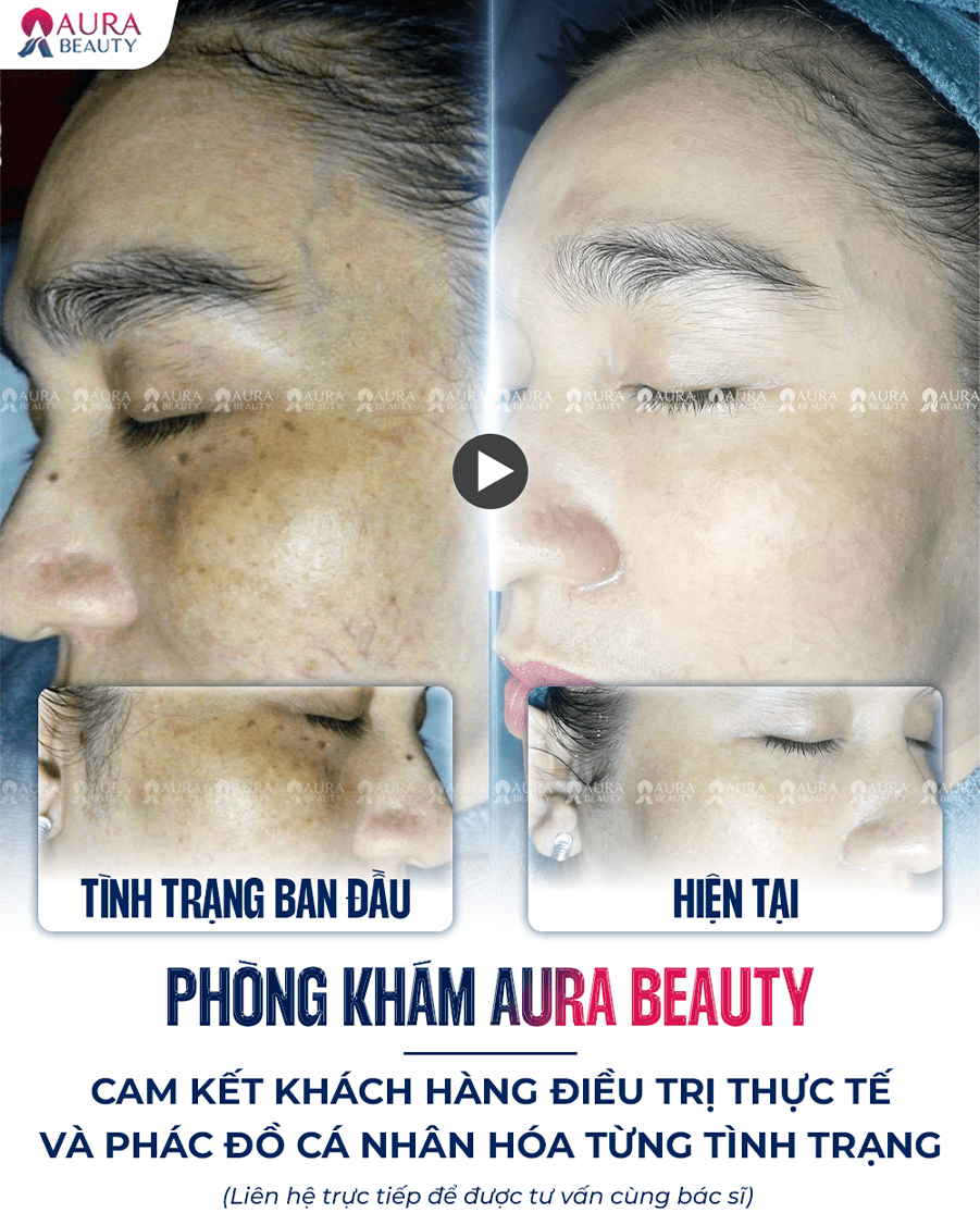 Búp bê mắt đen — Aura Beauty