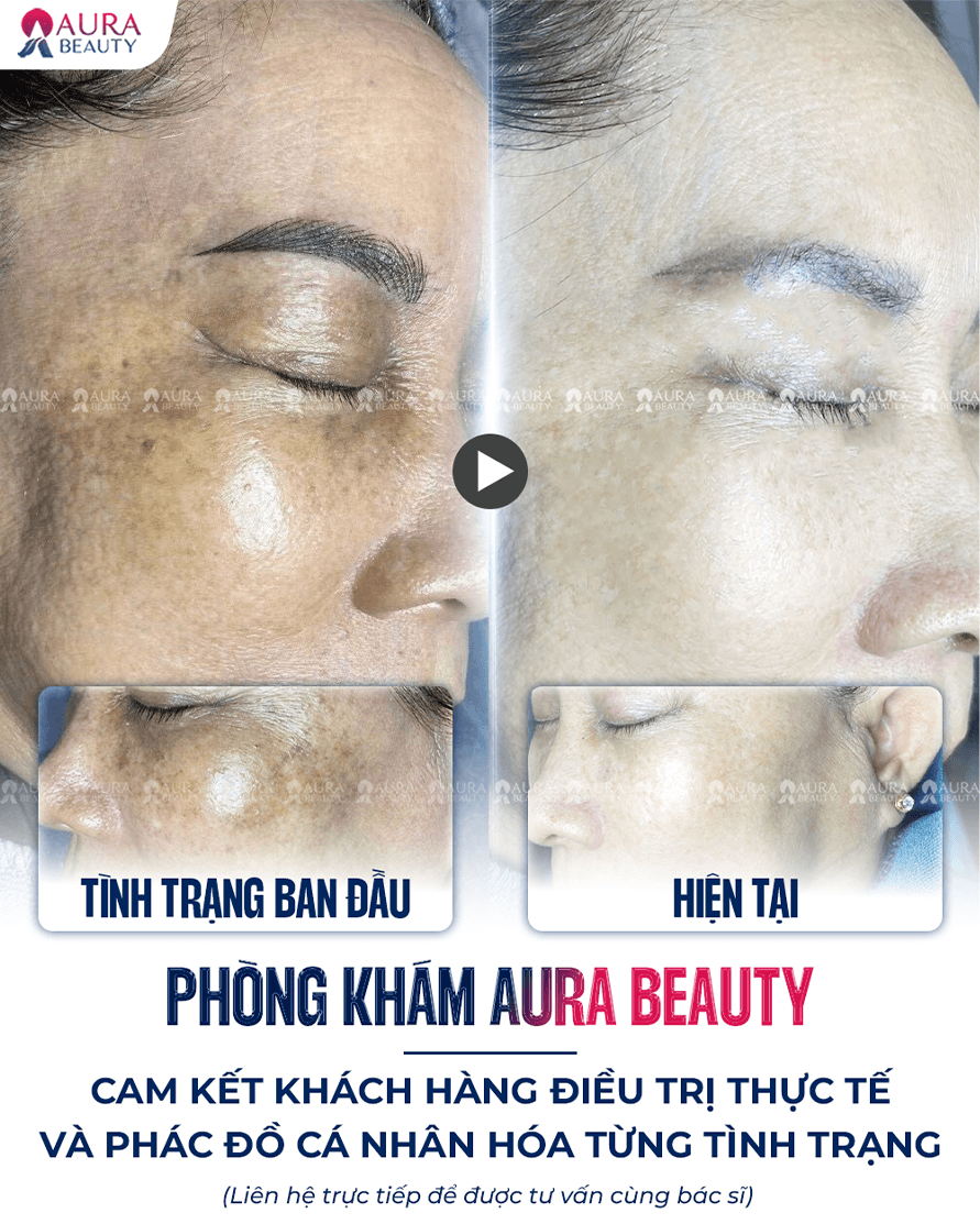 Búp bê mắt đen — Aura Beauty