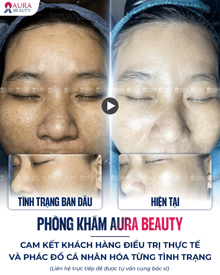 Búp bê mắt đen — Aura Beauty