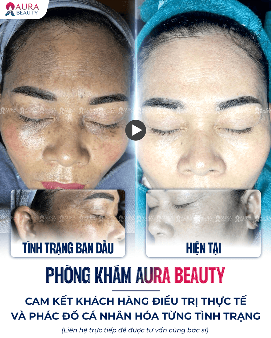 Búp bê mắt đen — Aura Beauty