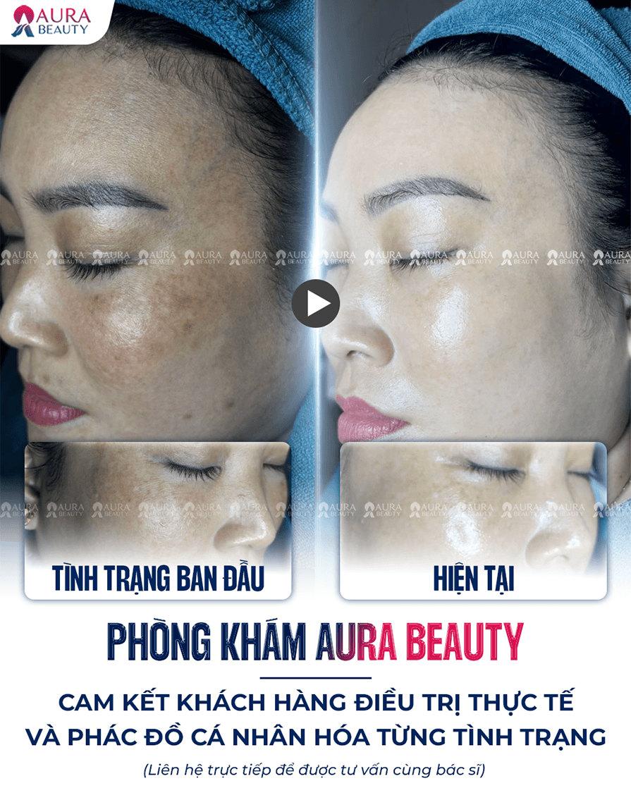 Búp bê mắt đen — Aura Beauty