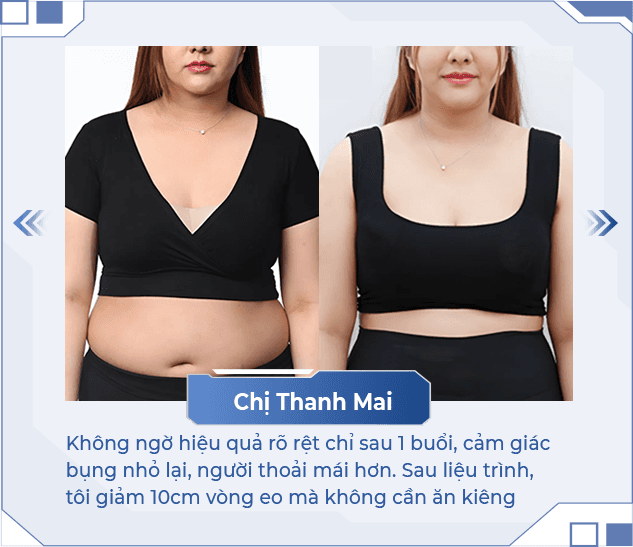 Giảm béo MaxVip — Aura Beauty