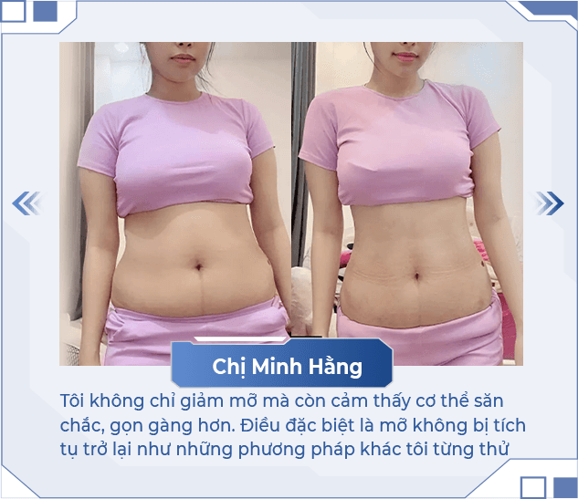 Giảm béo MaxVip — Aura Beauty
