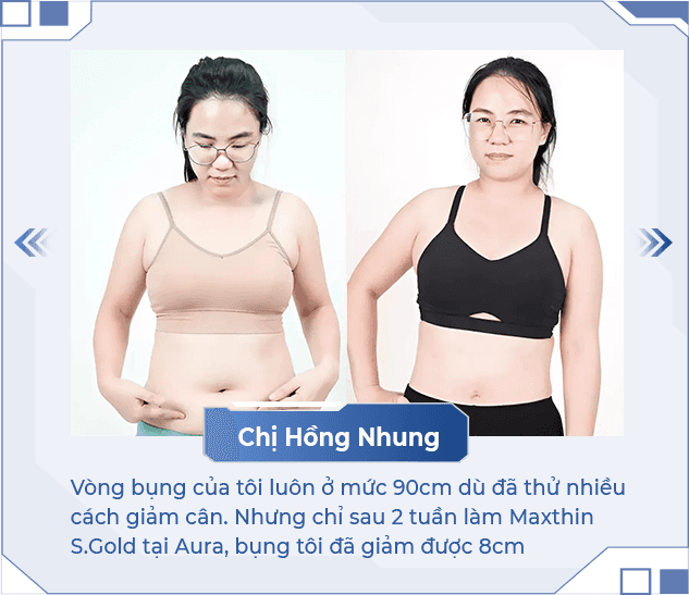 Giảm béo MaxVip — Aura Beauty