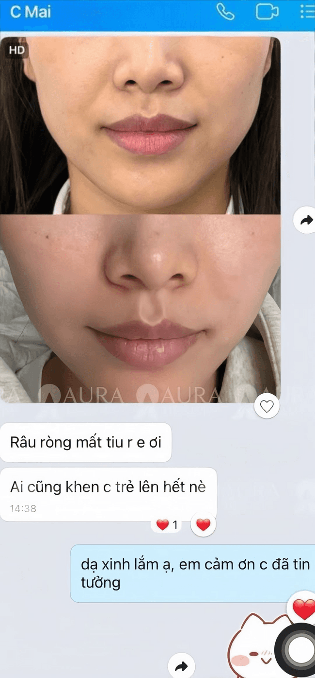 HA MD Codes — Aura Beauty