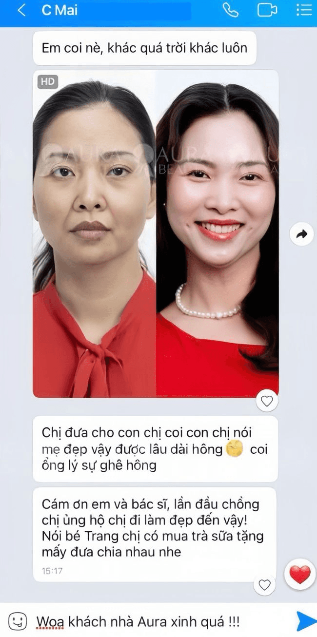 HA MD Codes — Aura Beauty