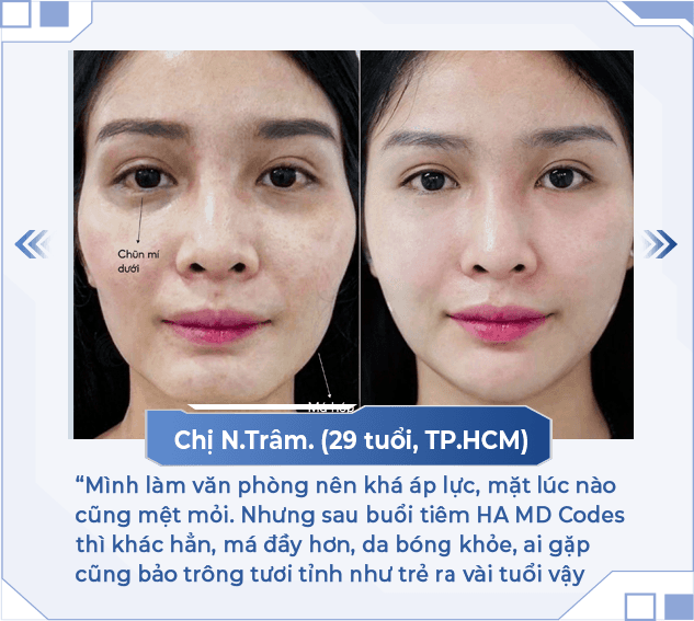 HA MD Codes — Aura Beauty