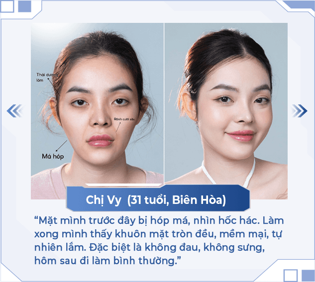 HA MD Codes — Aura Beauty