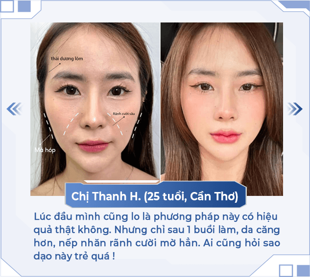 HA MD Codes — Aura Beauty