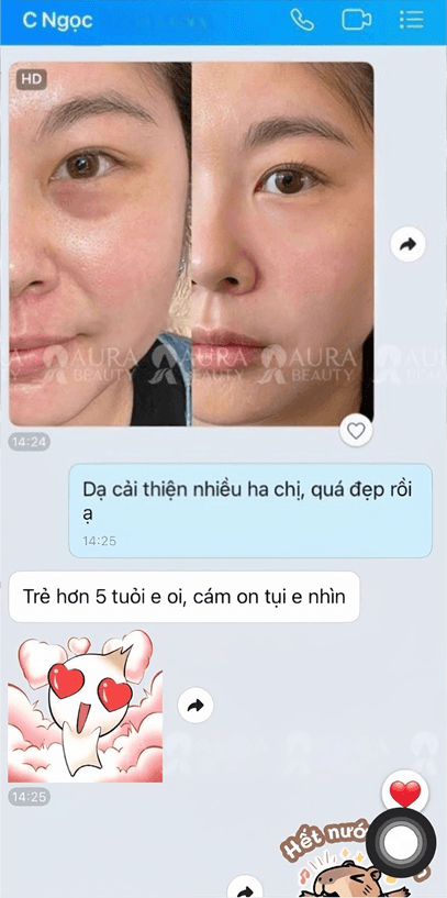 HA MD Codes — Aura Beauty