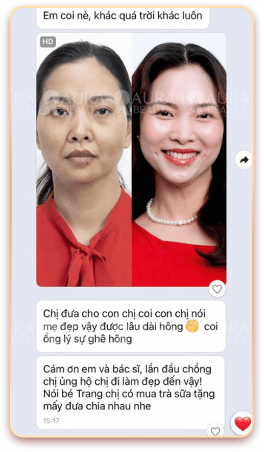 Skin Gold Therapy — Aura Beauty