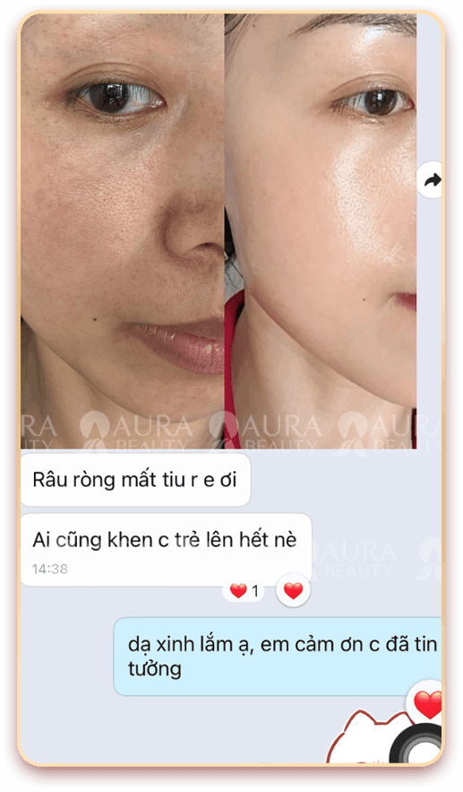 Skin Gold Therapy — Aura Beauty