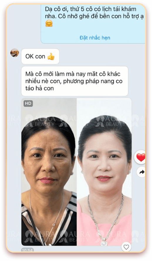 Skin Gold Therapy — Aura Beauty
